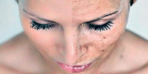 Medizinisches Peeling